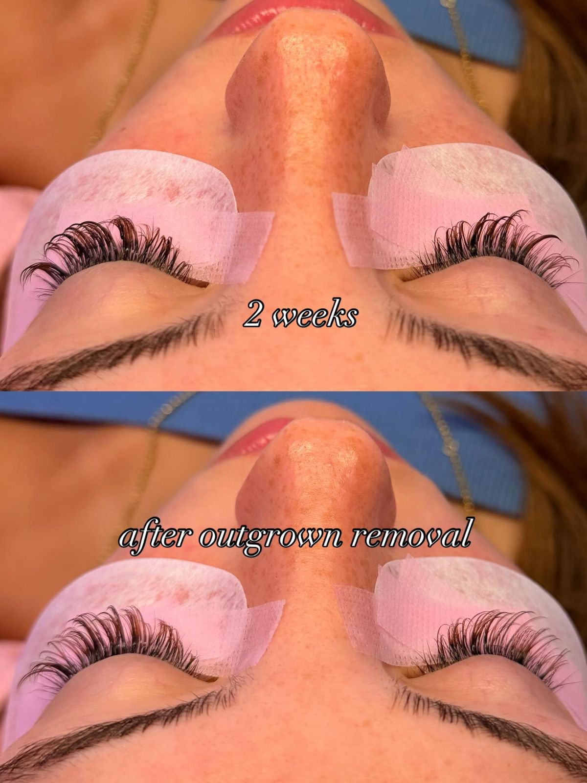 Wispy set at 2 weeks, then after outgrown removal