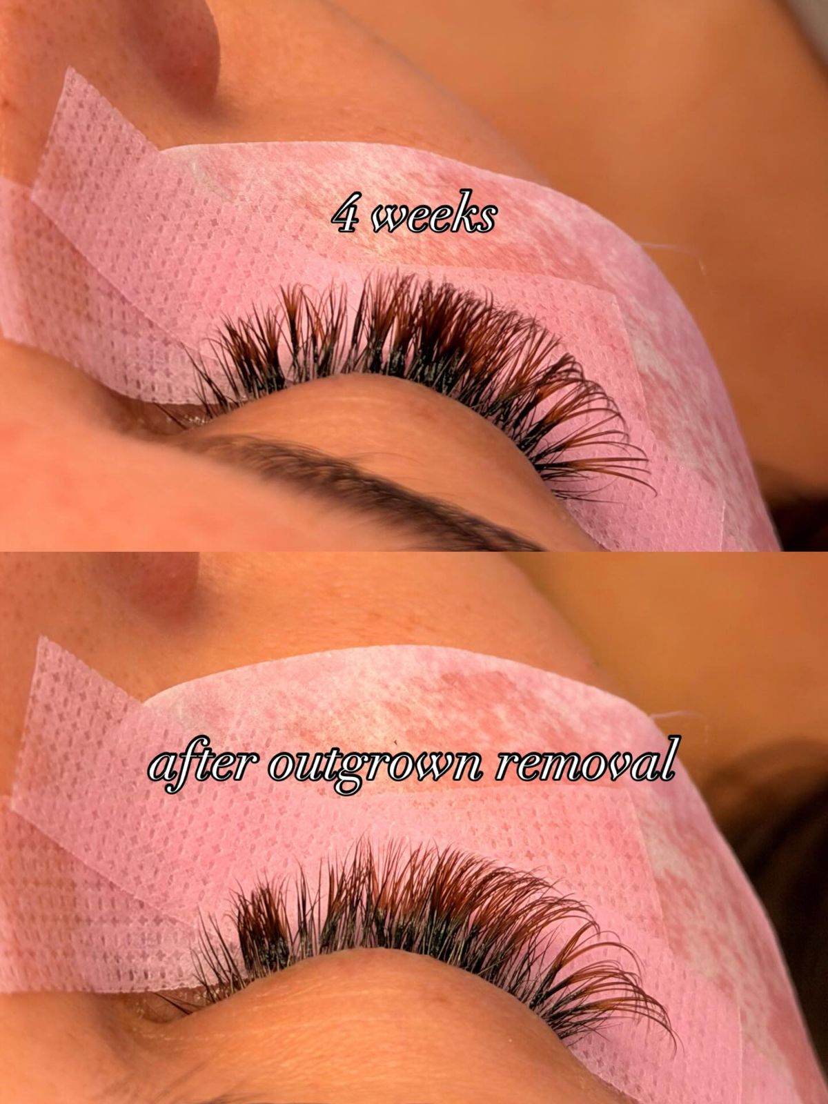 Set at 4 weeks, then after outgrown removal