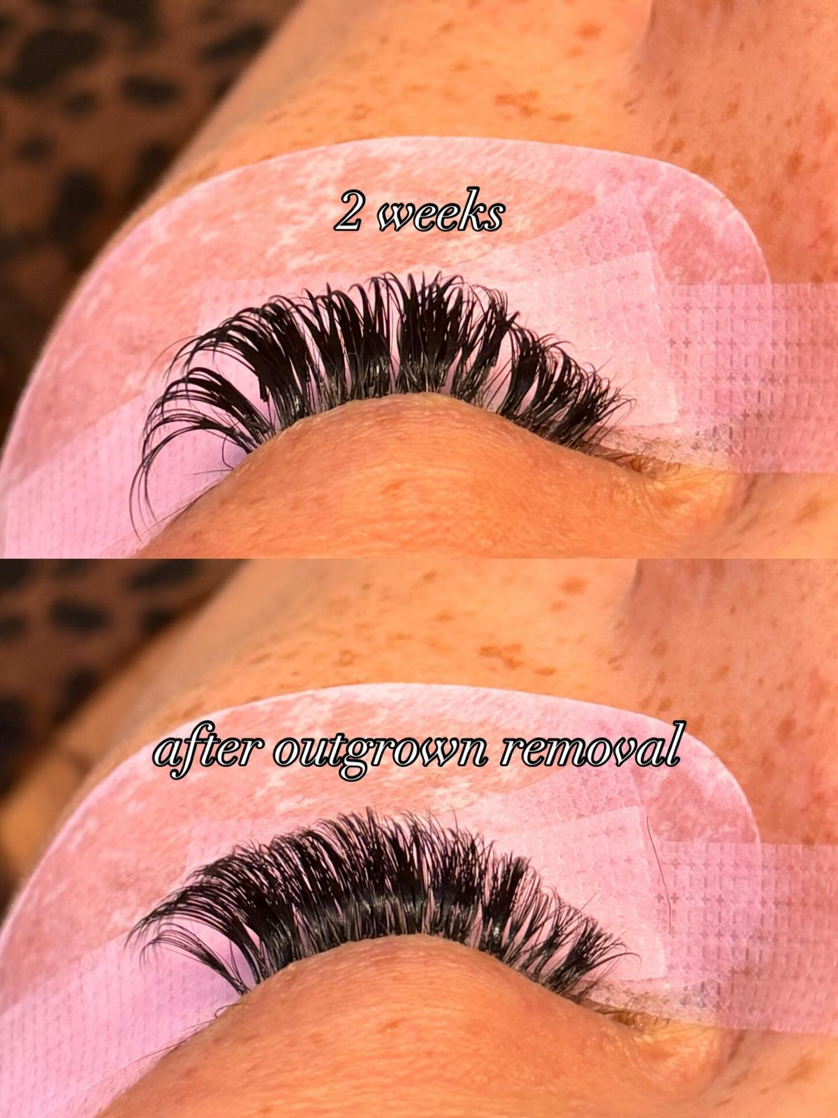 Set at 2 weeks, then after outgrown removal